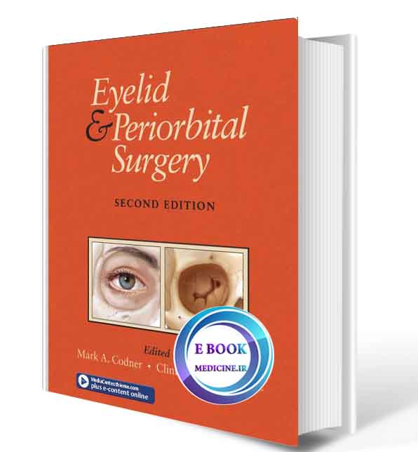 دانلود کتاب Eyelid & Periorbital Surgery 2016( ORIGINAL PDF)  